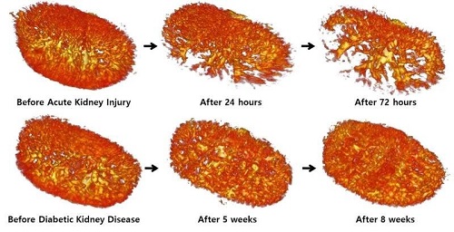 無造影劑成像腎臟結構首次完成